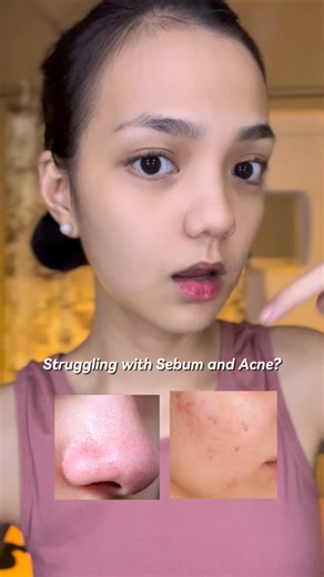 Holy Basil for Sebum and Acne control? 🌿 @p.calm_official ‘s Holy Basil Bubble Deep Mask contains AHA, PHA and montmorillonite clay that helps clean out skin sebum and gunk. #PcalmBubbleDeep #PCALM #YesStyle #blackhead #koreanskincare | Precious Ann