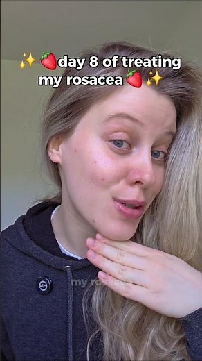 day 8 of soolantra 🌿 rosacea update #rosacea #ivermectin #skinjourney
