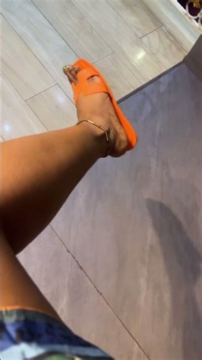 Look at my hands😩. And it’s itching. May this video blow up🤣