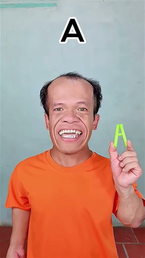😂 One Says “A”, The Other Says “H” | Funny Acting & Comedy 🤣 | Rohit Xo
