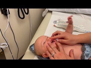 Mayo Clinic Minute: Tongue-tie in babies