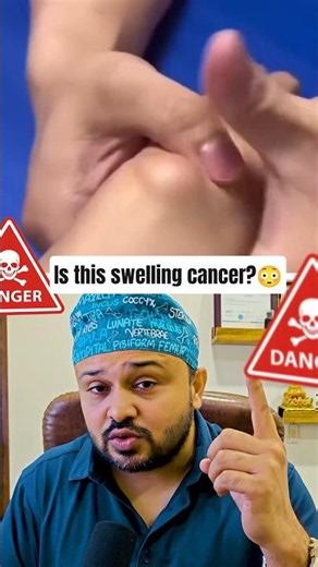 😳Ganglion cyst or Cancer?-truth about wrist lump