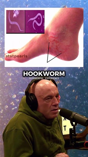 Why Walking Barefoot in the South Used to Be Dangerous - Joe Rogan Experience