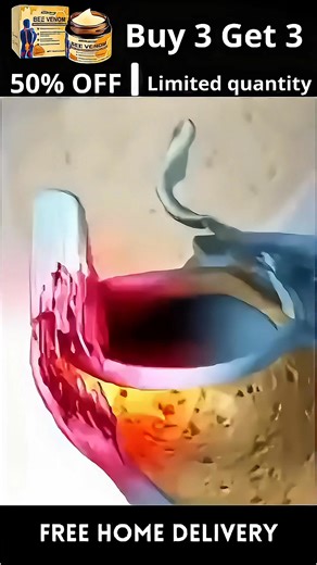 🦴 Are you struggling with bone-related issues or arthritis pain? Introducing ODALIT™ Botulinum Toxin & Bee Venom Pain-Relief Bone Healing Cream 🐝💊,specially designed for seniors and recommended by top orthopedic specialists in the U.S. 🇺🇸 This product complies with FDA regulations, has undergone rigorous allergy testing, and is clinically proven for safety and effectiveness. It repairs joint tissue, reduces swelling, and shows significant improvements in just 2-3 weeks! ✅ 🔹 Benefits: ✔ Ins