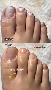 8.9K views · 477 reactions | 2 in 1 nail strengthen ceramic pen infused with oil that clean your cuticle, nail surface and remove dead skin easily, strengthen your natural nails and bring the shine of your natural nails back For more information please visit our website: www.secret-nails.com | Secret Nails | Facebook