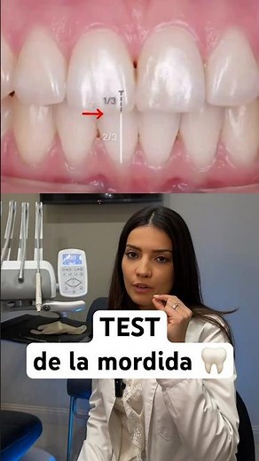 El secreto de una sonrisa perfecta (NO son las carillas) 🤫 Test de Mordida