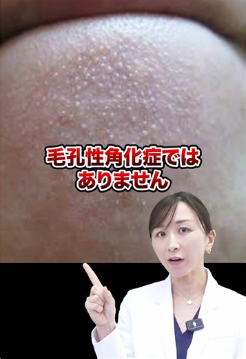 皮脂フィラメントのケア方法と注意点