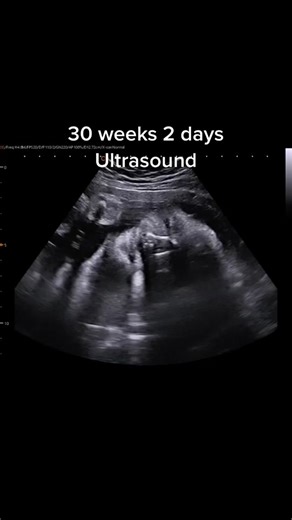 JerBearImaging on TikTok