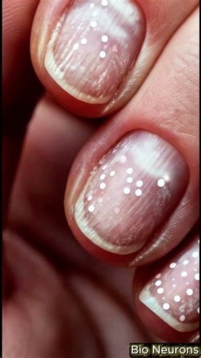 Your Nails Are a Health Diary — Here’s What They Reveal