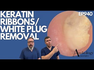 KERATIN RIBBONS/EAR WAX & WHITE PLUG REMOVAL FROM EAR - EP940