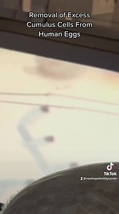 Check out this quick video of what happens in the embryology lab immediately after an egg retrieval! 🥚 🔬 Our embryologists quickly check each egg retrieved and then remove any excess cumulus cells to help with the egg stripping process. What is egg stripping? When an egg is retrieved from a woman's ovary it is surrounded by cumulus cells. These cells are removed from the egg during “stripping” so that the egg can then be injected/inseminated by the sperm. 💉 💦 #infertility #fertility #fertili