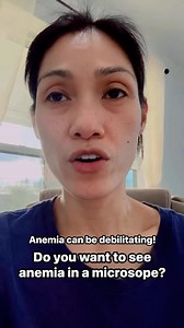 How does anemia looks like in the microscope? | Farrah Bunch Jack Bunch