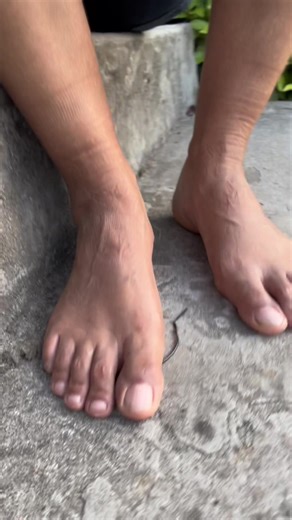 foot podiatry (@foot.podiatry)’s videos with som original - foot podiatry