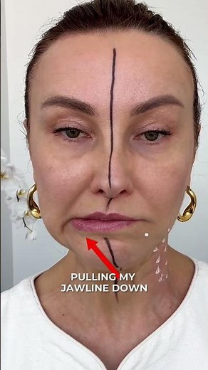 HOW THE NEFERTITI LIFT WORKS 💉✨