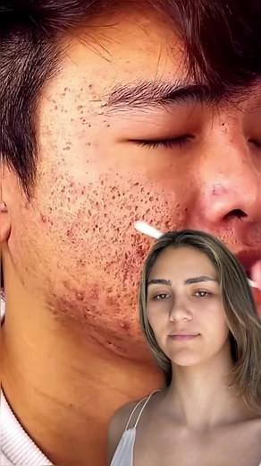Effective Mud Mask for Clear Skin | Skincare Routine
