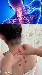 Neck pain relief massage tutorial #neckmassage #neckpain | 다이어트