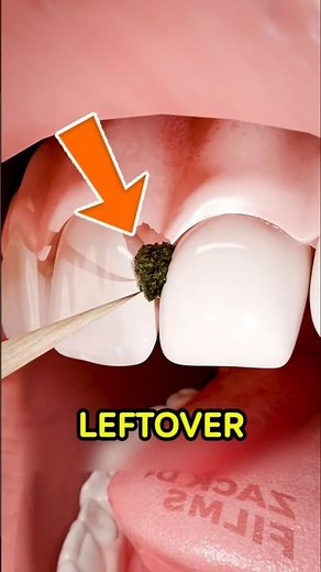 Why You Should NEVER Clean Your Teeth With a Toothpick!