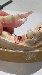 Another unique case! | Luke Kahng