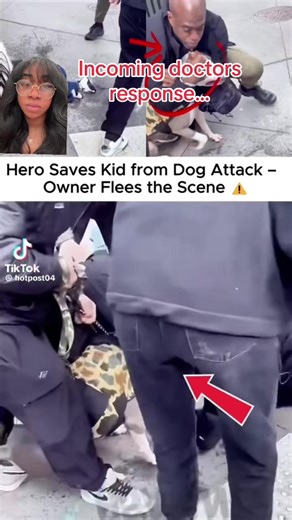 Dog bites can be fatal #fyp #fypシ