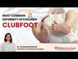 Clubfoot - Complete Information Diagnosis, Exercise Treatment at Home, Shoes, Surgery.
