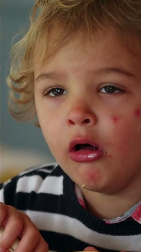 Whooping Cough: What You Need to Know