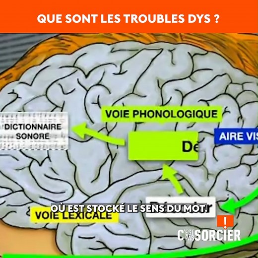 Les troubles DYS, si méconnus et souvent difficiles à diagnostiquer... | C'est pas sorcier