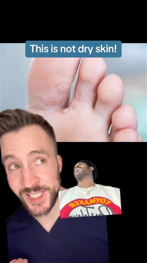 1.4M views · 36K reactions | Athletes foot? Do this and it’ll be gone in a week or so. 欄 | Justin Kelly | Facebook