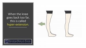 Knee Hyperextension Test: One Sign You’ve Damaged Your PCL