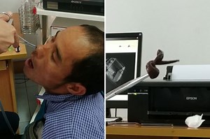 Disgusting mystery creature pulled out of man’s nose