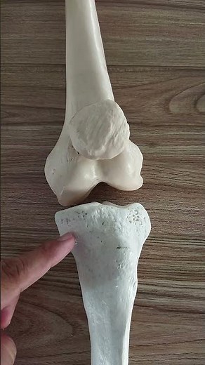 Condylar Joint of the knee #draqilshah #viralvideos #anatomy #youtubeshorts #viral #shortsvideo #dr