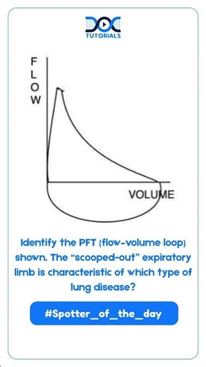Spotter of the Day | MBBS