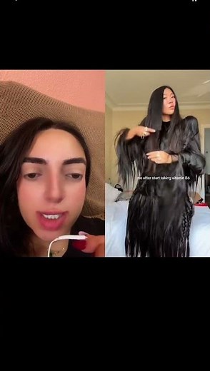 Vitamin B6 makes your hair grow 😮