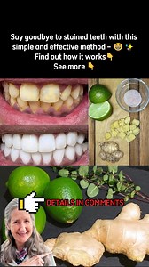 Say goodbye to stained teeth with this simple and effective method – ✨ Find out how it works See more  | Clean Life Hacks | Facebook
