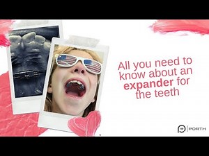 A guide to an expander for teeth: how to turn it, how to clean it and how to avoid breaking it
