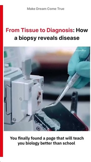 🧬 From Tissue to Diagnosis: 🔬 How a Biopsy Reveals Disease 🧑🏻‍⚕️ | MDCT