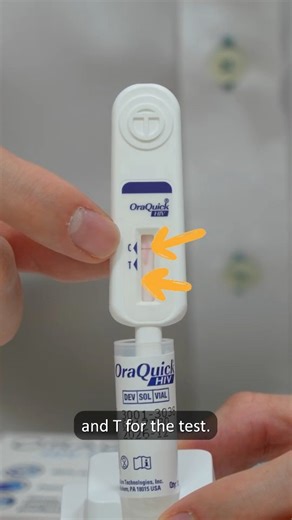 3.7K views · 19 reactions | #DidYouKnow that you can now purchase HIV self-test kit over the counter at selected pharmacies? Here’s a step-by-step guide on how to use the kit! For more information on HIV, visit for.sg/nuh-hiv #hiv #selftestkit | National University Hospital - NUH | Facebook