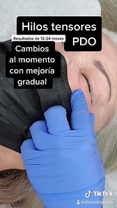 1.6K views · 29 reactions | 淋 Este tipo de hilo tensor PDO no tiene...