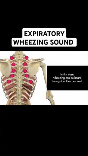 Expiratory wheezing sound