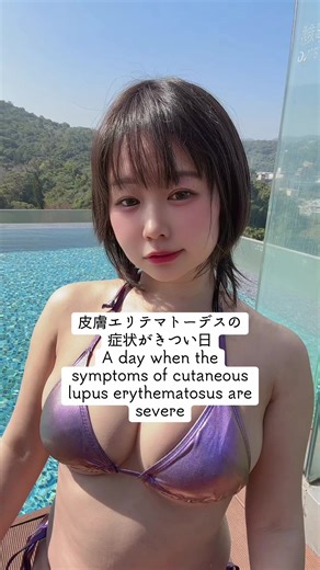 難病でも頑張って活動してるので撮影会とかイベント逢いに来てくれませんかマジで