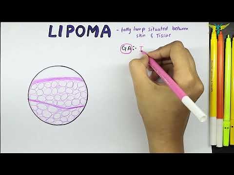 Lipoma Histopathology | Benign Mesenchymal tumor Histopathology | Gross | Microscopy