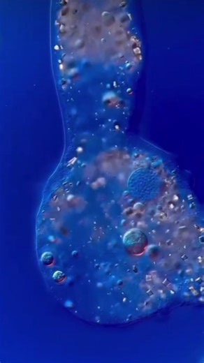 How an Amoeba Moves Under a Microscope