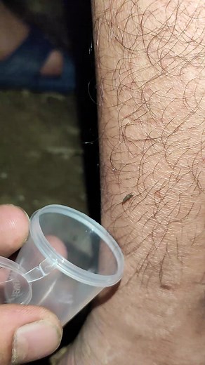 Amazing Techinique to catch mosquito #mosquito #mosquitoes #mosquitobites #mosquitorepellent #mosquitokiller #mosquitocontrol #mosquitos #mosquitofree #zika #malaria #controledepragas | Lexus Pet Boutique