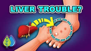 These are 5 symptoms of liver problems your legs REVEAL