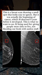 10K views · 151 reactions | “It Wasn’t Counterfeit Money—It Was the Sharpie!” | The History Canvas | Facebook