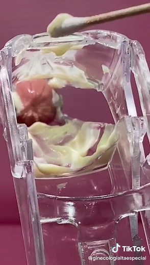 Entendiendo la Leucorrea: Síntomas y Causas