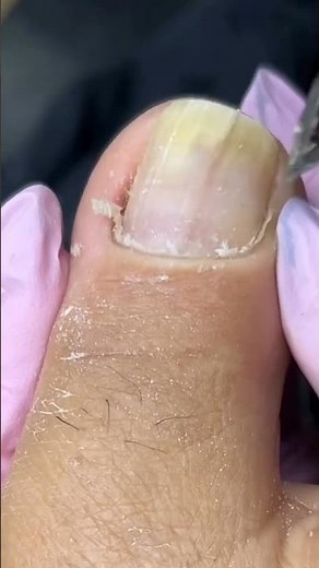 Would you like to learn aesthetic pedicures, foot spas, and ingrown toenail techniques? 👣