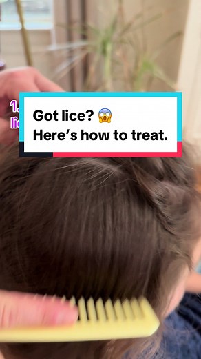Got lice? 😱 Here’s how to get rid of them! 🪲 1. Over-the-Counter Treatments: Use lice shampoos containing permethrin or pyrethrin. Follow the instructions carefully, and remember to repeat the treatment after 7-10 days to kill any newly hatched lice. 2. Prescription Medications: If OTC treatments don’t work, your dermatologist may prescribe stronger options like ivermectin, spinosad, or malathion. 3. Nit Removal: After treatment, use a fine-tooth comb to remove nits (lice eggs) from the hair. 
