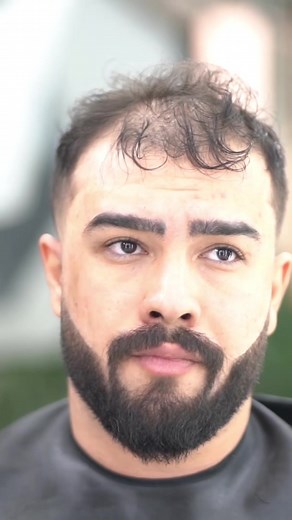 🌟 Unleash Your Hair’s Full Potential with THICK FIBER! Tired of dealing with thin, lifeless hair? Look no further! Experience the incredible transformation that THICK FIBER offers today! 💆‍♀️✨ Say farewell to flat, lackluster locks, and welcome the newfound confidence of voluminous, luscious hair! 🙌 Available @amazon Done by @shahramamiri__ Don’t let your hair hold you back any longer - try THICK FIBER now and witness the instant boost! 💫 Embrace the beauty of thick, full hair and rock any s