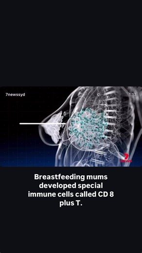 BAMBIS BREASTFEEDING SUPPORT🤱🤱🏽 on Instagram: "Research explains how breast cancer risk is reduced by #breastfeeding “We found that women who have breastfed have more specialised immune cells, called CD8⁺ T cells, that ‘live’ in the breast tissue for decades after childbirth,” says Prof Loi, who is a Peter Mac clinician scientist. “These cells act like local guards, ready to attack abnormal cells that might turn into cancer. This protection may have evolved to defend mothers during the vulner