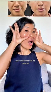 130K views · 2.2K reactions | No, you don’t need Botox, fillers, or...